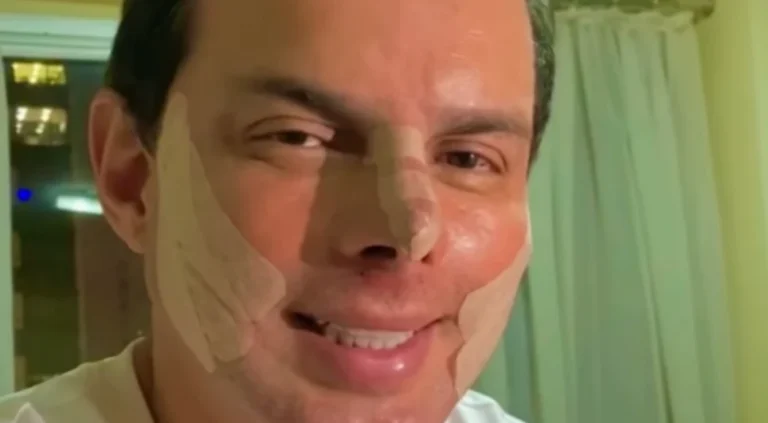 Marido de Gretchen, Esdras de Souza faz procedimento no nariz: “Feliz”