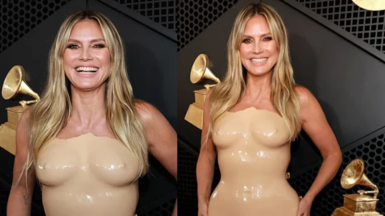 Heidi Klum mostra machucados causados por look usado no Grammy 2026