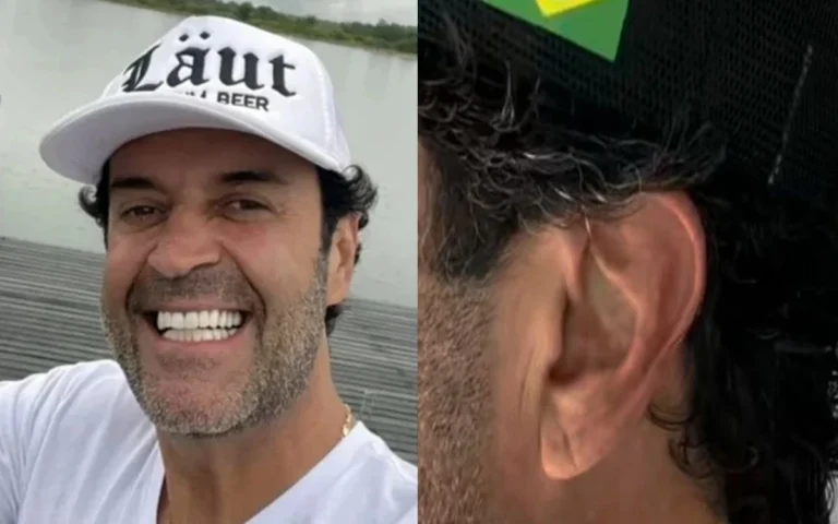 Sinal de Frank: após morte de Henrique Maderite, médico faz alerta assustador sobre quem tem essa dobrinha na orelha