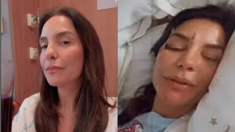 Vídeo mostra como ficou o rosto de Ivete Sangalo após a cantora ser encaminhada às pressas para o hospital