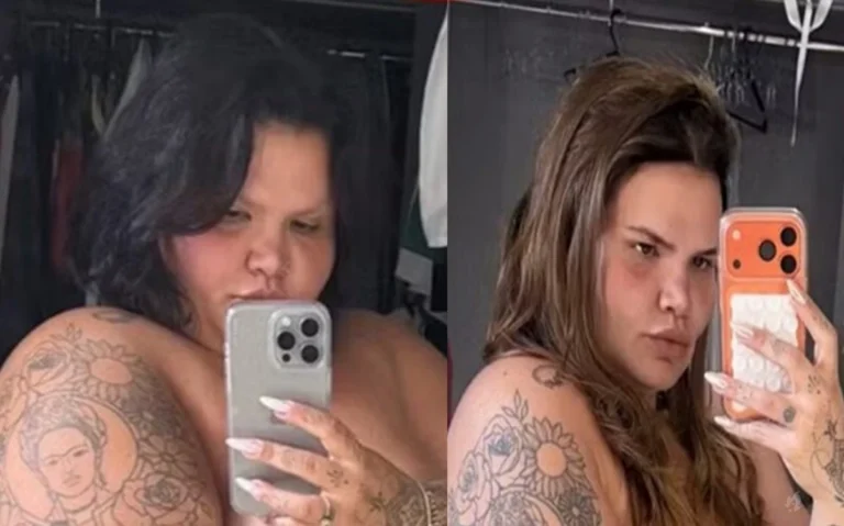 Thais Carla choca a web ao mostrar antes e depois após perder 85 kg