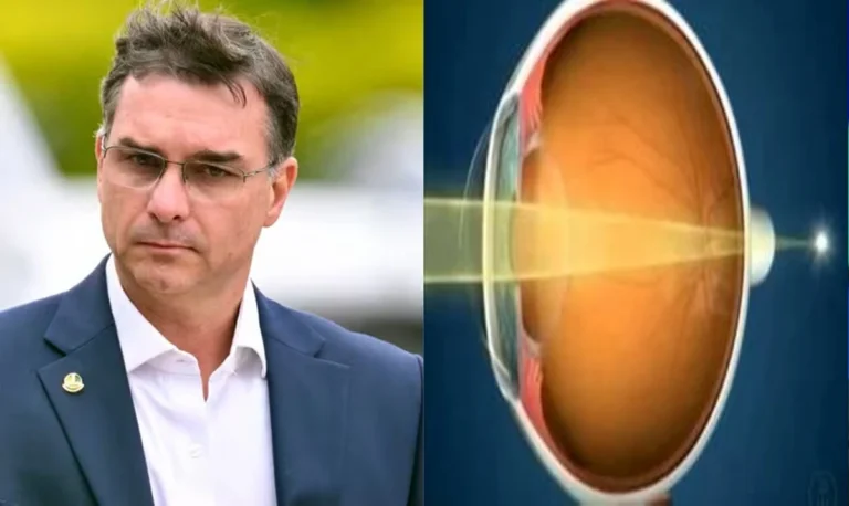 Entenda os sintomas do problema de visão de Flávio Bolsonaro