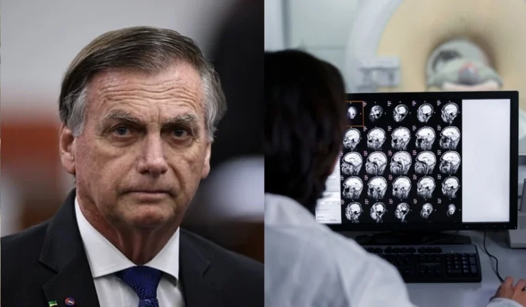 Bolsonaro realiza tomografia e exames de sangue, diz médico