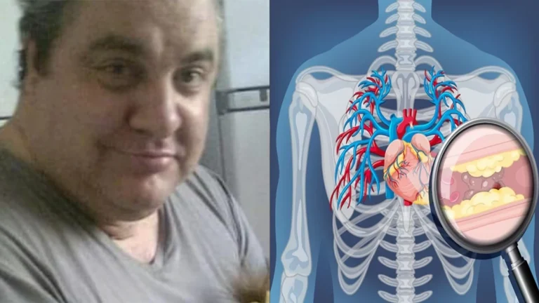 Causa da morte de Gerson Brenner é revelada; entenda