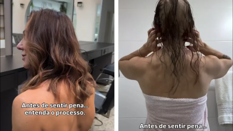 Mãe de Lucas Lucco mostra evolução após o diagnóstico de alopecia