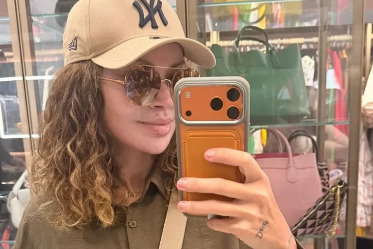 Mudança de Solange Almeida levanta debate sobre procedimentos faciais