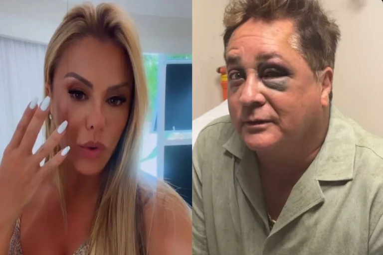 Poliana Rocha entrega detalhes sobre estado de saúde de Leonardo após acidente