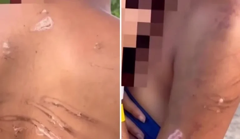 Adolescente é torturada com mangueira de gás por facção criminosa