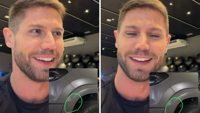 Ex-BBB Jonas Sulzbach tranquiliza fãs após acidente de carro: Dei uma raspadinha