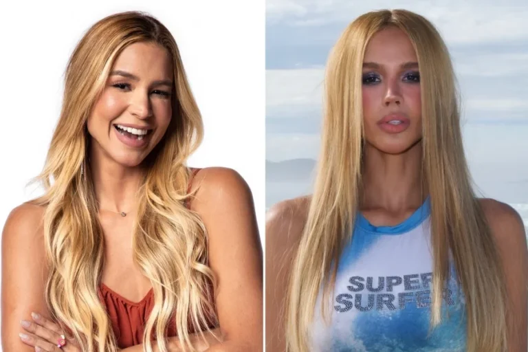 O que a ex-BBB Kerline fez para mudança radical em “novo rosto”