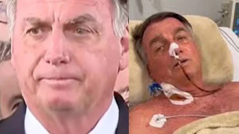 Cirurgia de Bolsonaro: hospital quebra o silêncio e entrega detalhes sobre estado de saúde do ex-presidente