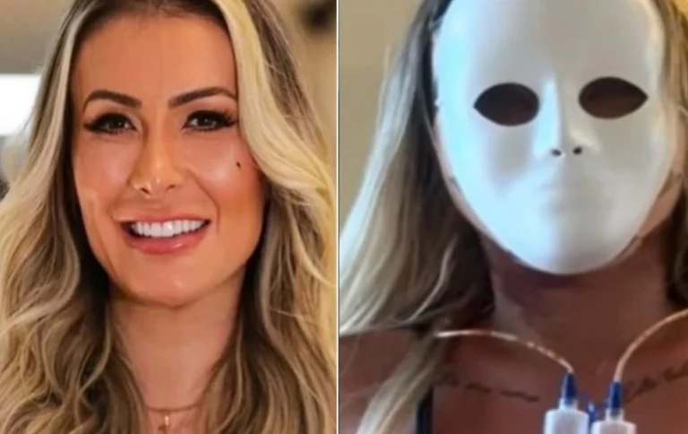 Andressa Urach exibe novo rosto após 50ª plástica e reação viraliza: “Voltar aos 23 anos”