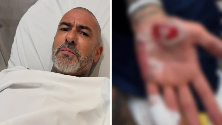 Fogaça sofre acidente de moto e denuncia roubo de aliança em hospital
