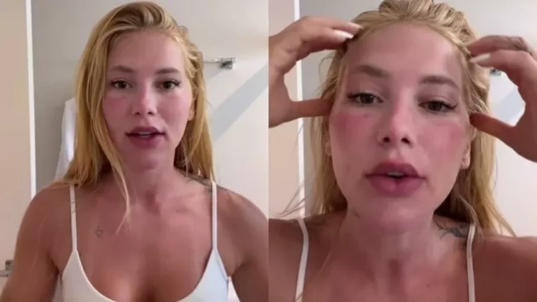 Grave? Virginia Fonseca aparece com rosto inchado e assusta seguidores