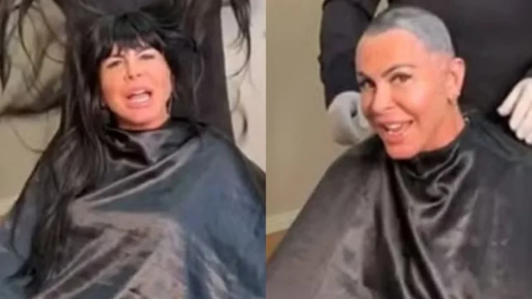 Gretchen raspa a cabeça antes de transplante capilar; vídeo