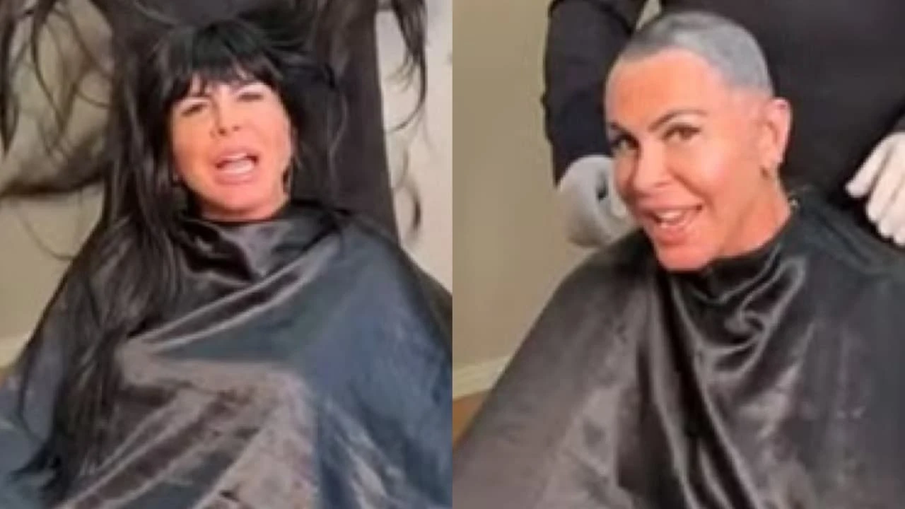 Gretchen raspa a cabeça antes de transplante capilar; vídeo