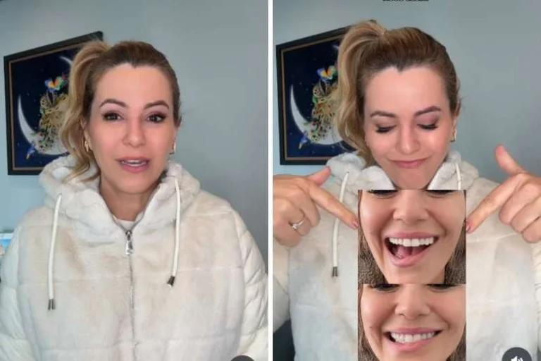 Ex-Panicat Tania Oliveira revela intercorrência em retirada de tumor: ‘Meu sorriso ficou comprometido’